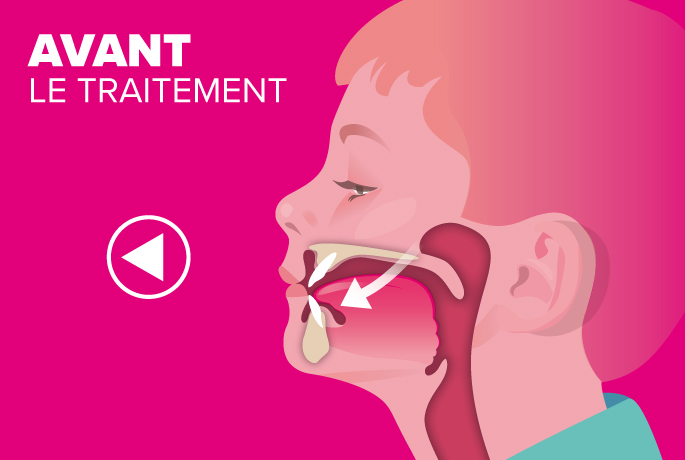 Position de la langue : Une solution douce en 3 étapes | SPOONY GLOSS